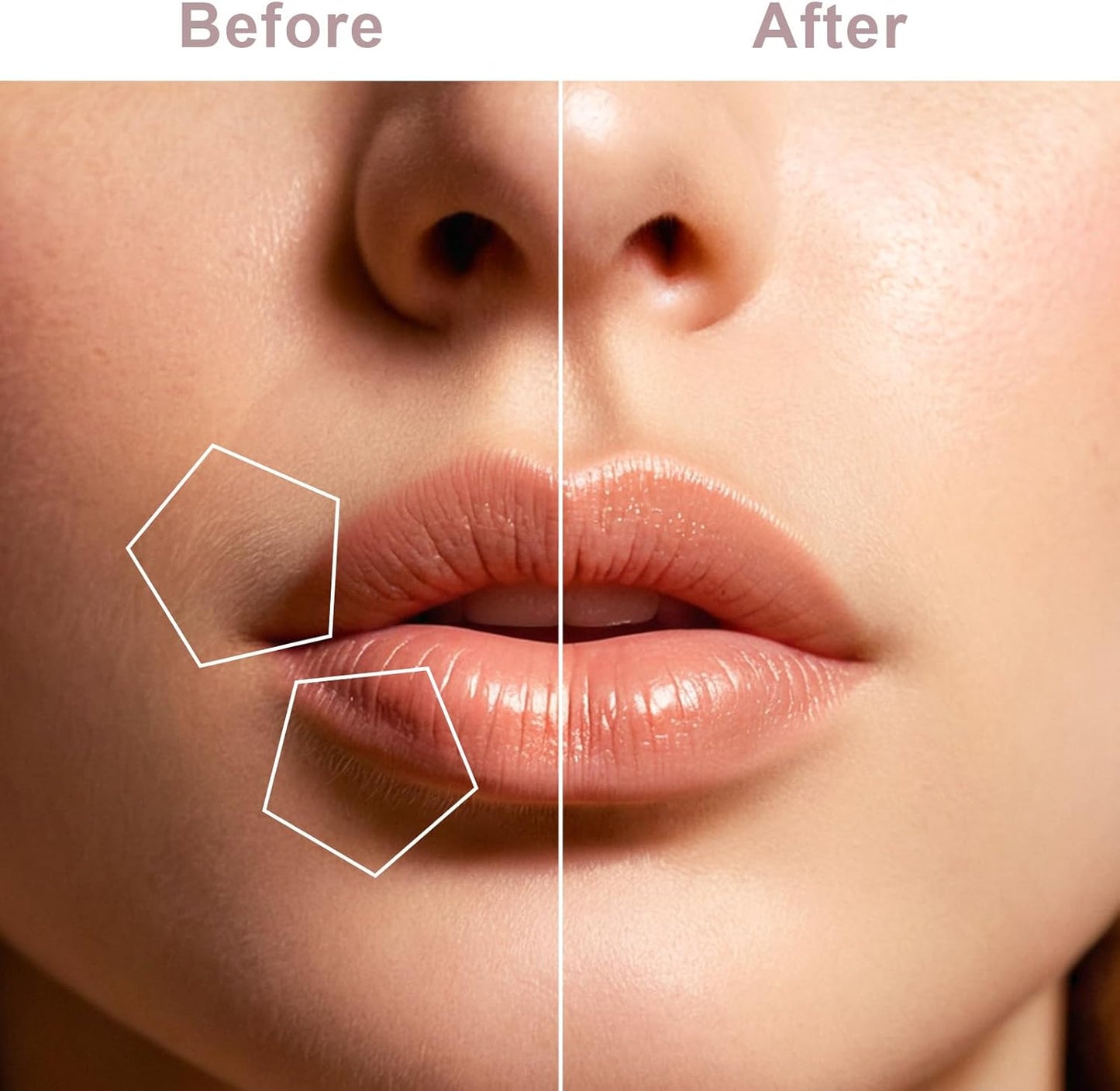 Flawless Electric Hair Remover – Portable & Skin-Friendly for Daily Use